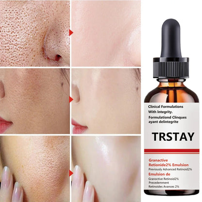 Luxury Smooth Facial Emulsion, Soft Texture with Long-Lasting Nourishment, Creates Silky & Skin-Friendly Skin Texture